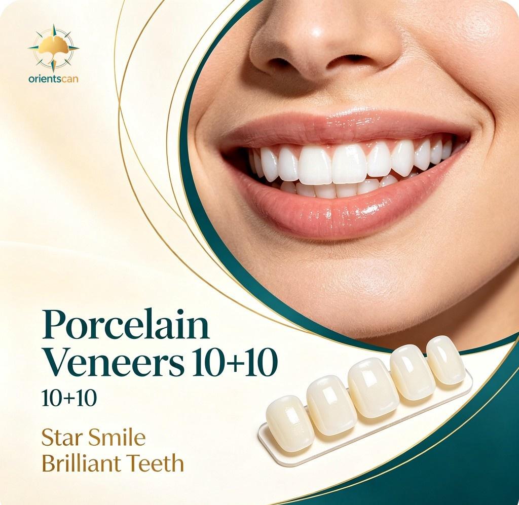 Porcelain Veneer (10 Upper + 10 Lower)