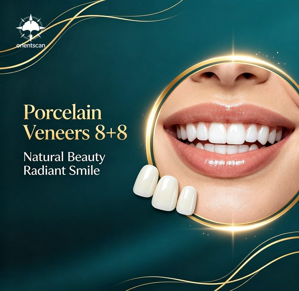 Porcelain Veneer (8 Upper + 8 Lower)
